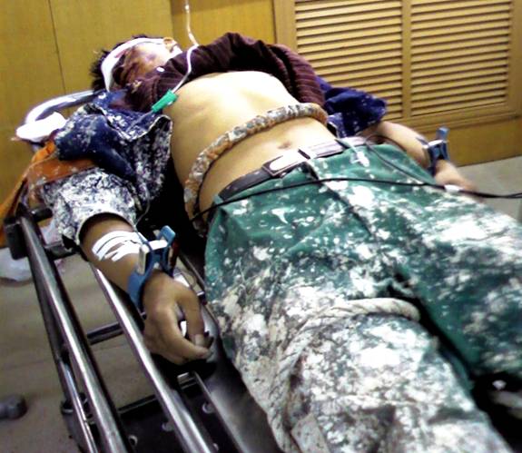 安全事故照片--慘不忍睹